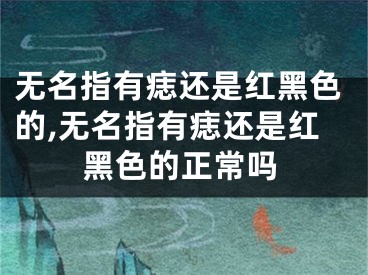 无名指有痣还是红黑色的,无名指有痣还是红黑色的正常吗