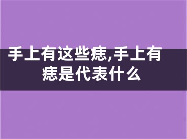 手上有这些痣,手上有痣是代表什么