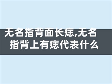 无名指背面长痣,无名指背上有痣代表什么