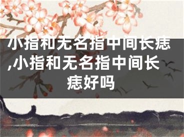 小指和无名指中间长痣,小指和无名指中间长痣好吗