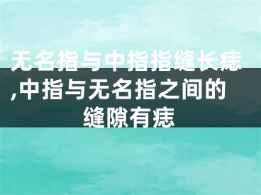 无名指与中指指缝长痣,中指与无名指之间的缝隙有痣